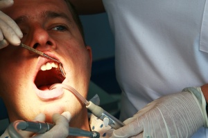 Dental Treatment by Expert Dentist